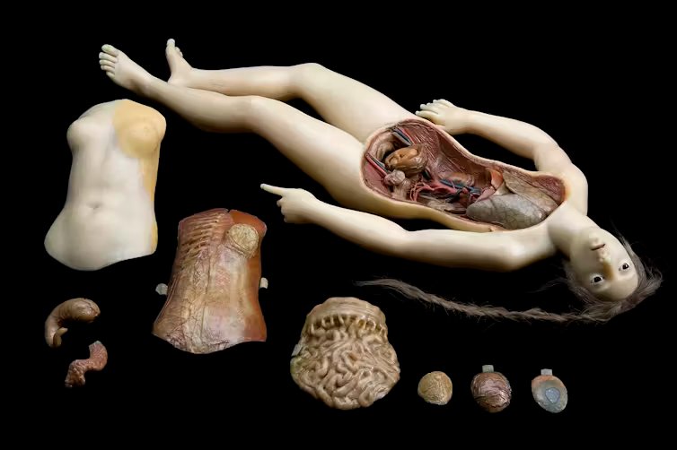 Venus anatómica.