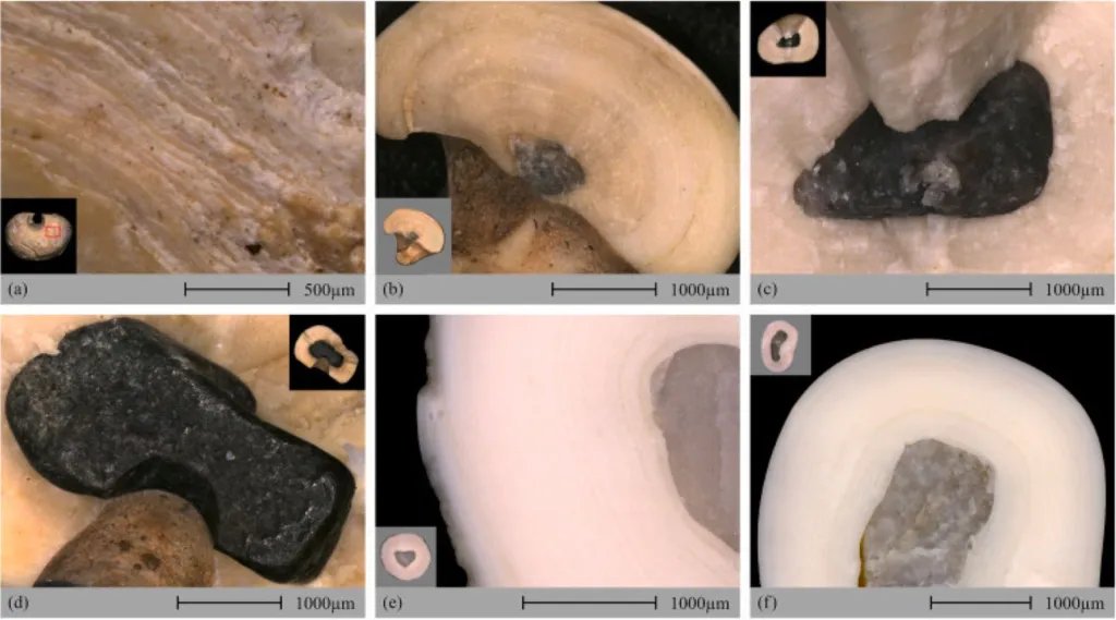 Imágenes microscópicas de algunos ejemplares de perlas