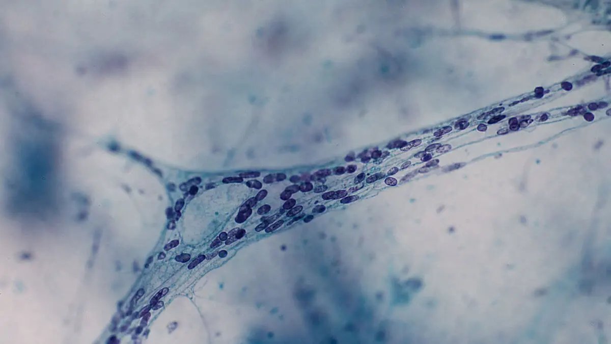 Microscopio, neurita con acumulaciones dentro; mitocondrias agrupadas tipo placa, enfoque selectivo, profundidad de campo baj